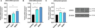 Specialized Proresolving Mediators Facilitate the Immunomodulation of the Periodontal Ligament Stem Cells